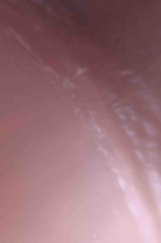 THE BIRTHMARK El lunar en su espalda